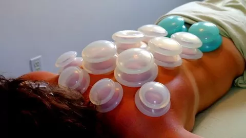 Learn Basic to Advanced Silicone Cupping Therapy in 2020