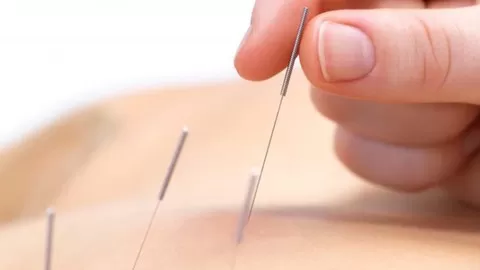 Receive an Qualification in Dry Needling therapy