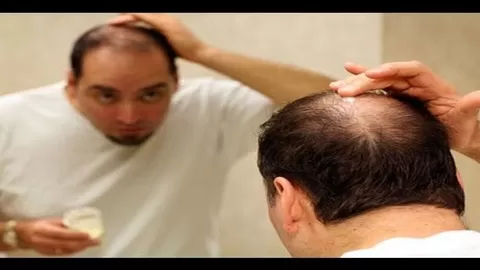 Alternative treatments for hair loss