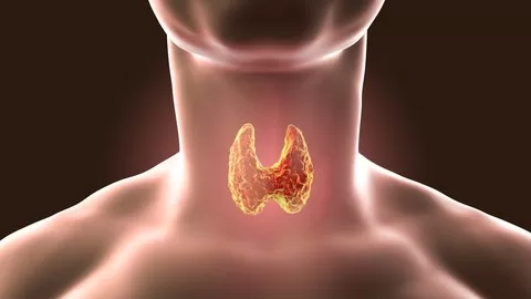 Manage and permanently Cure Hypo and Hyperthyroidism with Remedies and lifestyle changes